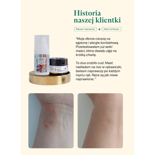 Maść z nagietka lekarskiego - regenerująca skórę [30 ml]