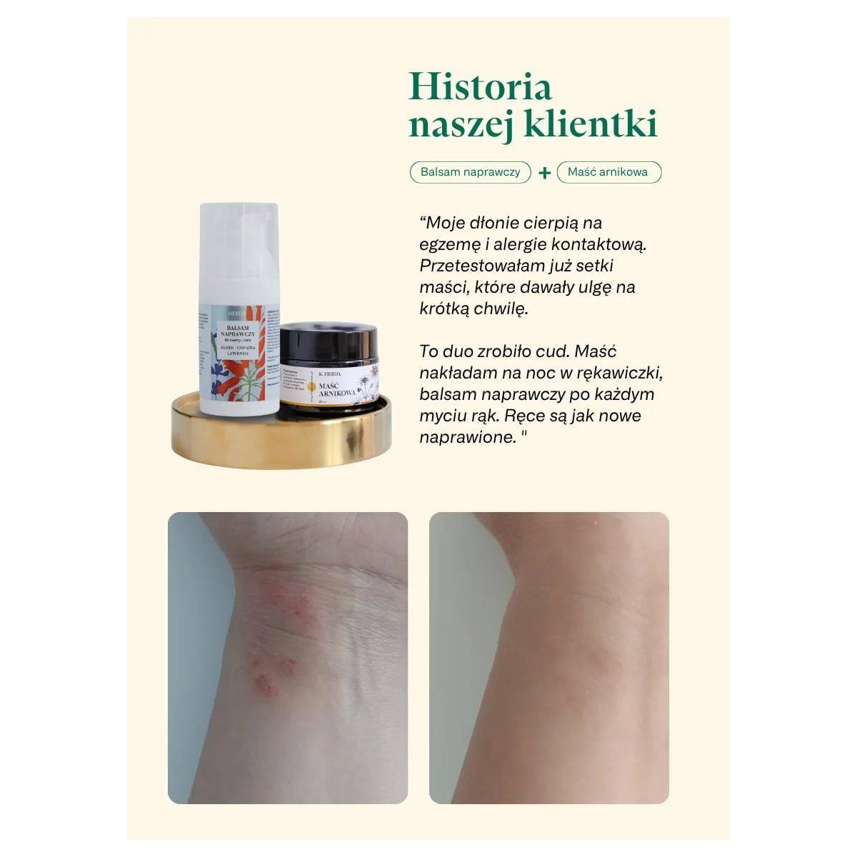 Maść z nagietka lekarskiego - regenerująca skórę [30 ml]